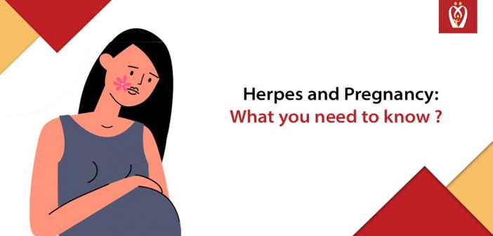 Herpes And Pregnancy What You Need To Know Nurturey Blog