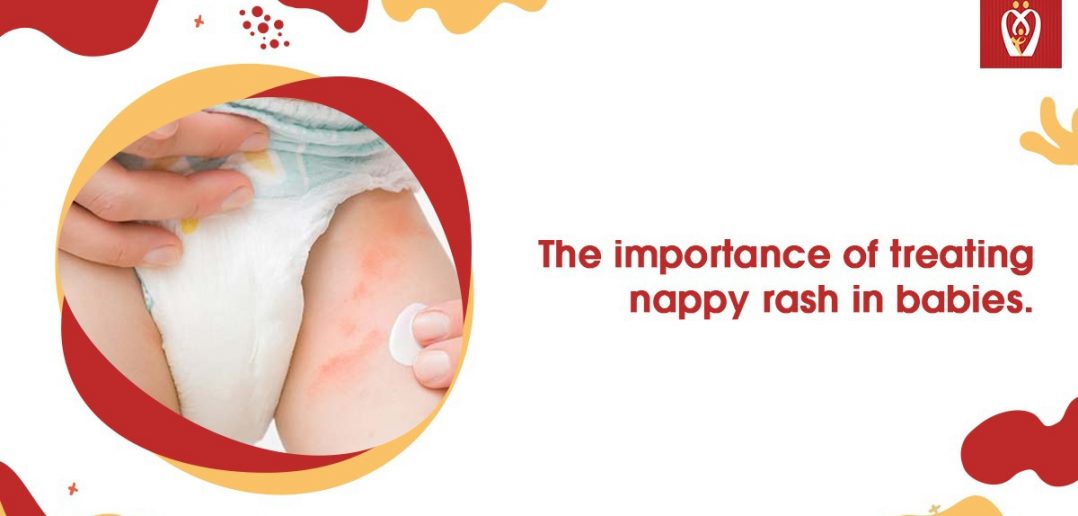 the-importance-of-treating-nappy-rash-in-babies-nurturey-blog